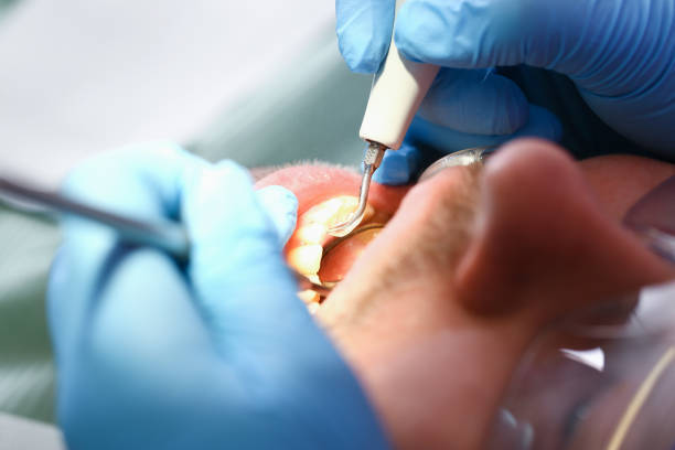 Best Cosmetic Emergency Dentistry in Long Beach, MS